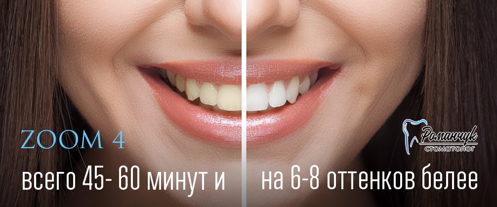 отбеливание зубов zoom-4 СПб